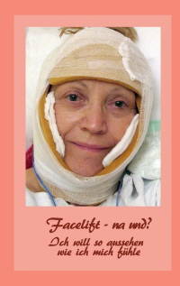 Facelift – na und