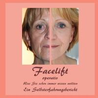 Facelift-operativ-Cover_1 Facelift-operativ-Cover_1